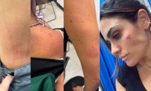 “Nos metieron una putiza”: Alcaldesa de Cuauhtémoc denuncia agresión tras operativo en San Cosme