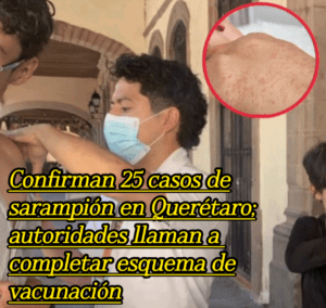 Confirman 25 casos de sarampión en Querétaro; autoridades llaman a completar esquema de vacunación